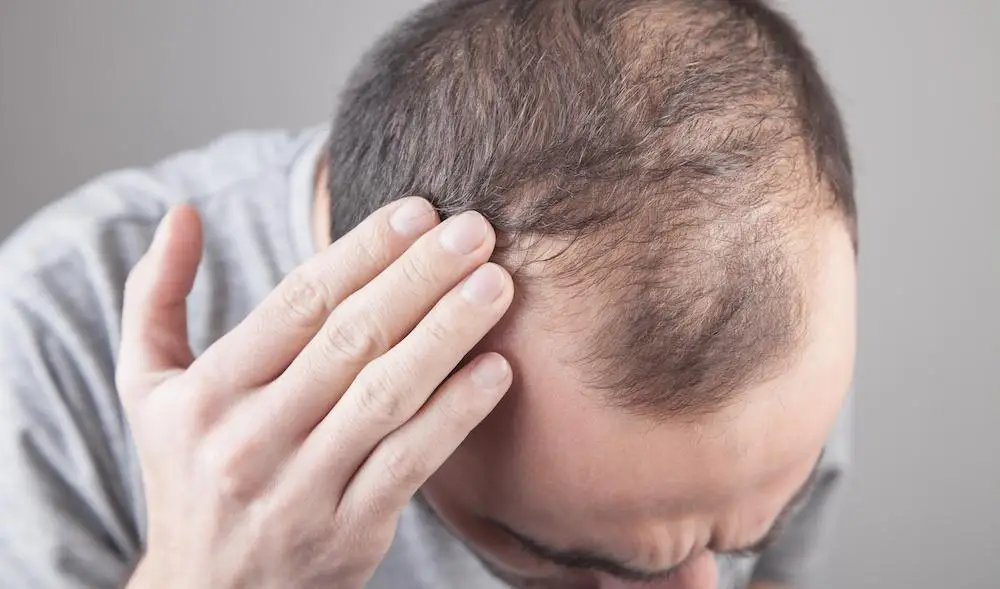 Concerned About Hair Loss? Learn How All-Natural PRP Can Help – Modern Aesthetica, Beverly Hills