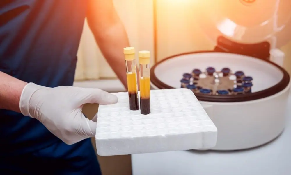 4 Ways PRP Therapy Can Improve Your Health and Wellness – Modern Aesthetica, Beverly Hills