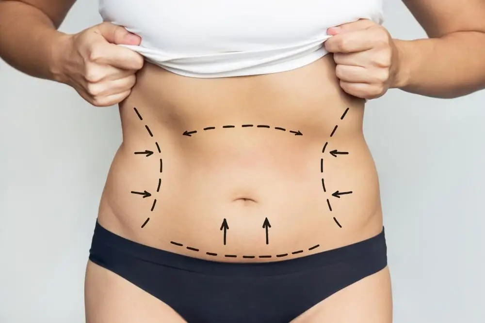 How Lipotropic Injections Can Support Your Weight Loss Efforts – Modern Aesthetica, Beverly Hills